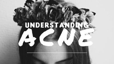 Understanding the Acne Problem